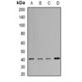 LifeSab™ MacroH2A1 Rabbit pAb (50 µl)