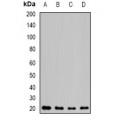 LifeSab™ NAT5 Rabbit pAb (50 µl)