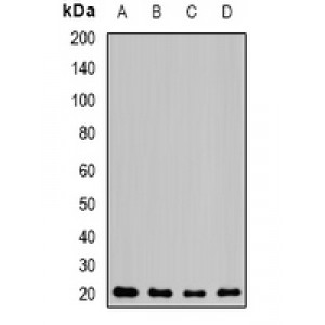 LifeSab™ NAT5 Rabbit pAb (50 µl)