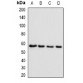 LifeSab™ SMYD1 Rabbit pAb (50 µl)