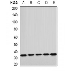 LifeSab™ ETFA Rabbit pAb (50 µl)
