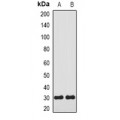 LifeSab™ Carbonic Anhydrase 3 Rabbit pAb (50 µl)