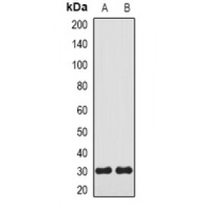 LifeSab™ Carbonic Anhydrase 3 Rabbit pAb (50 µl)