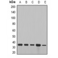 LifeSab™ Cyclin D2 Rabbit pAb (50 µl)