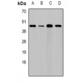 LifeSab™ DAP Rabbit pAb (50 µl)