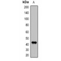 LifeSab™ DDB2 Rabbit pAb (50 µl)