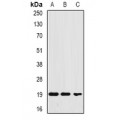 LifeSab™ Ferritin L Rabbit pAb (50 µl)