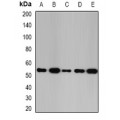 LifeSab™ Glutathione Synthetase Rabbit pAb (50 µl)