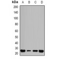 LifeSab™ GSTP1 Rabbit pAb (50 µl)
