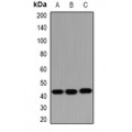 LifeSab™ HSD17B2 Rabbit pAb (50 µl)