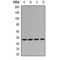 LifeSab™ IDH1 Rabbit pAb (50 µl)