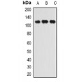 LifeSab™ INTS6 Rabbit pAb (50 µl)