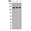 LifeSab™ KDM1A Rabbit pAb (50 µl)