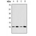 LifeSab™ LC3A Rabbit pAb (50 µl)