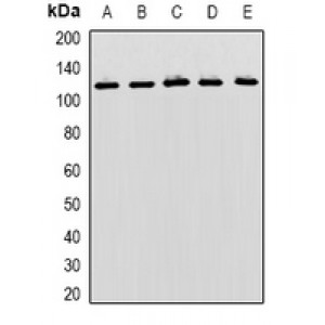 LifeSab™ MBTPS1 Rabbit pAb (50 µl)