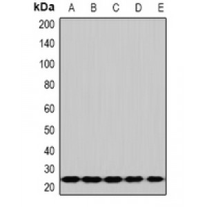 LifeSab™ RPS5 Rabbit pAb (50 µl)