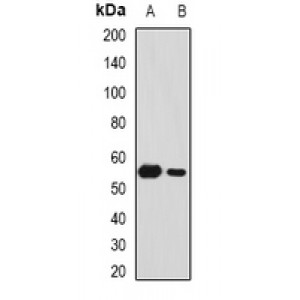 LifeSab™ SFRP4 Rabbit pAb (50 µl)