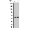 LifeSab™ SPHK1 Rabbit pAb (50 µl)