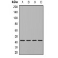 LifeSab™ TIA1 Rabbit pAb (50 µl)