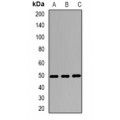 LifeSab™ Wilms Tumor 1 Rabbit pAb (50 µl)