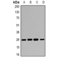 LifeSab™ 14-3-3 beta Rabbit pAb (50 µl)