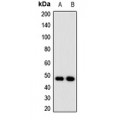 LifeSab™ NUDT6 Rabbit pAb (50 µl)