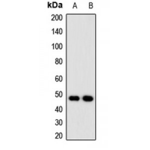 LifeSab™ NUDT6 Rabbit pAb (50 µl)