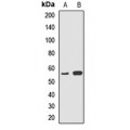 LifeSab™ Cytochrome P450 5A1 Rabbit pAb (50 µl)