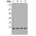 LifeSab™ REG3 alpha Rabbit pAb (50 µl)