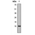 LifeSab™ Histone H3 (TriMethyl K9) Rabbit pAb (50 µl)