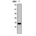 LifeSab™ Histone H3 (TriMethyl K27) Rabbit pAb (50 µl)