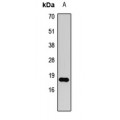 LifeSab™ Histone H3 (DiMethyl K79) Rabbit pAb (50 µl)