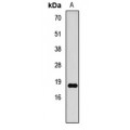 LifeSab™ Histone H3 (DiMethyl K79) Rabbit pAb (50 µl)