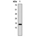 LifeSab™ Histone H3 (Symmetric DiMethyl R8) Rabbit pAb (50 µl)