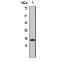 LifeSab™ Histone H3 (Symmetric DiMethyl R8) Rabbit pAb (50 µl)