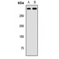 LifeSab™ SETD2 Rabbit pAb (50 µl)