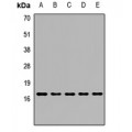 LifeSab™ Peroxiredoxin 5 Rabbit pAb (50 µl)