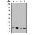 LifeSab™ NRBF2 Rabbit pAb (50 µl)