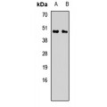 LifeSab™ CALU Rabbit pAb (50 µl)