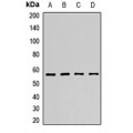 LifeSab™ NMT2 Rabbit pAb (50 µl)
