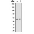 LifeSab™ TPH2 Rabbit pAb (50 µl)