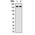 LifeSab™ ULK4 Rabbit pAb (50 µl)