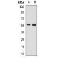 LifeSab™ SMAD9 Rabbit pAb (50 µl)
