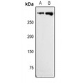 LifeSab™ Ki67 Rabbit pAb (50 µl)