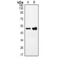 LifeSab™ GFAP Rabbit pAb (50 µl)