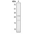 LifeSab™ IL-25 Rabbit pAb (50 µl)