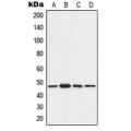 LifeSab™ AAMP Rabbit pAb (50 µl)