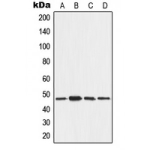LifeSab™ AAMP Rabbit pAb (50 µl)