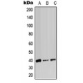 LifeSab™ ADH7 Rabbit pAb (50 µl)