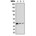LifeSab™ Beta-2 Adrenergic Receptor (pS346) Rabbit pAb (50 µl)